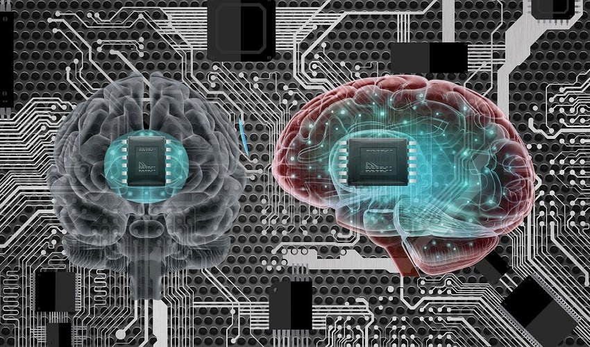 Test Neuralinkova moždanog čipa na ljudima za 6 mjeseci