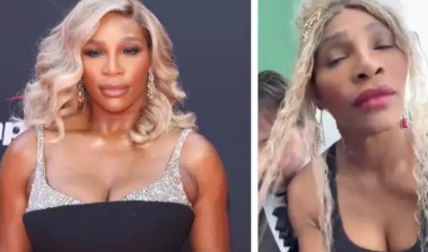 Serena Williams: Ne izbjeljujem kožu